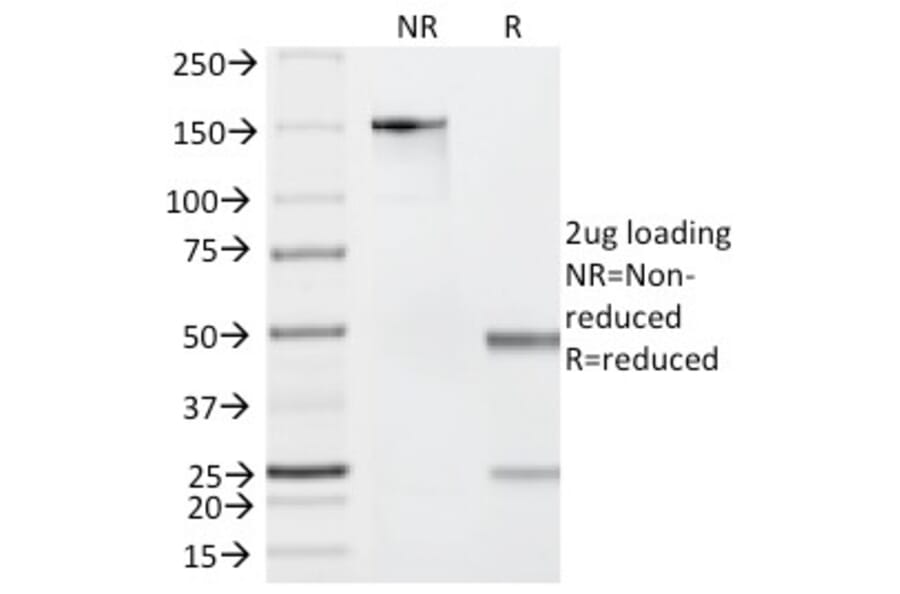 SDS-PAGE - Anti-Granzyme B Antibody [GZMB/2403] (A248798) - Antibodies.com