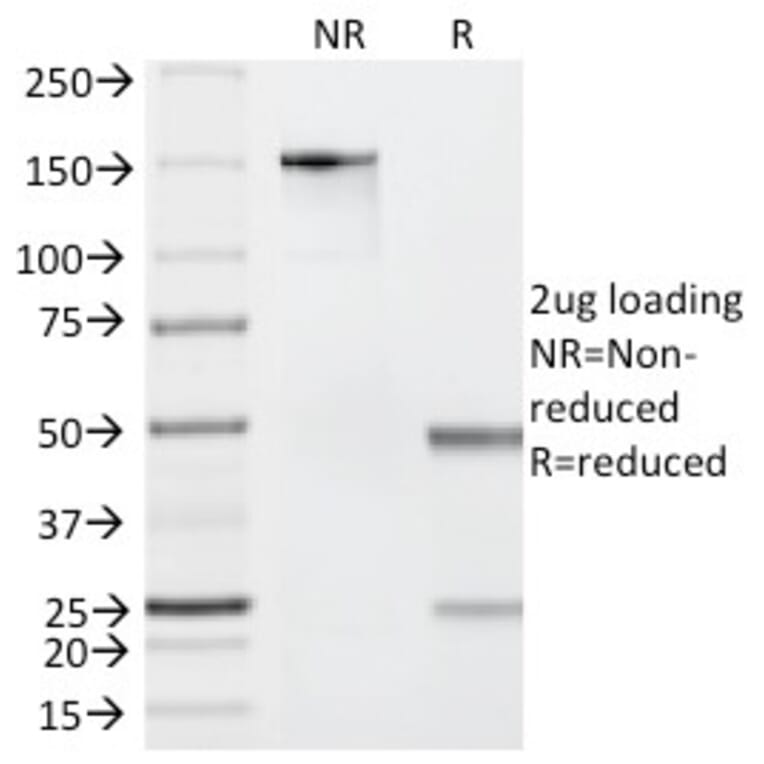 SDS-PAGE - Anti-Granzyme B Antibody [GZMB/2403] (A248798) - Antibodies.com