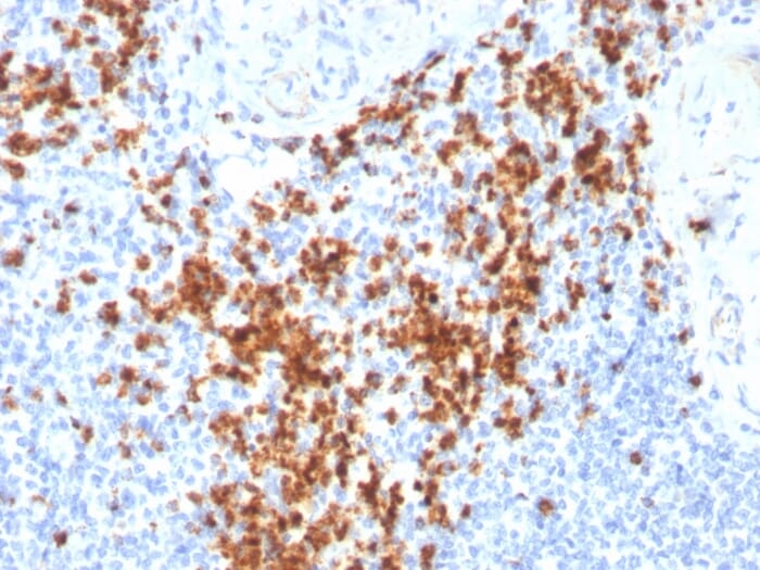 Anti-Granzyme B Antibody [GZMB/3014] (A248799) | Antibodies.com