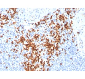 Immunohistochemistry - Anti-Granzyme B Antibody [GZMB/3014] (A248799) - Antibodies.com