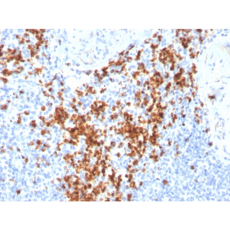 Immunohistochemistry - Anti-Granzyme B Antibody [GZMB/3014] (A248799) - Antibodies.com