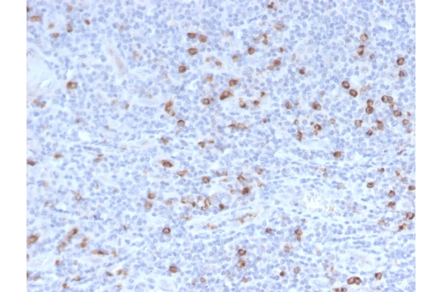 Immunohistochemistry - Anti-Granzyme B Antibody [GZMB/3014] (A248799) - Antibodies.com
