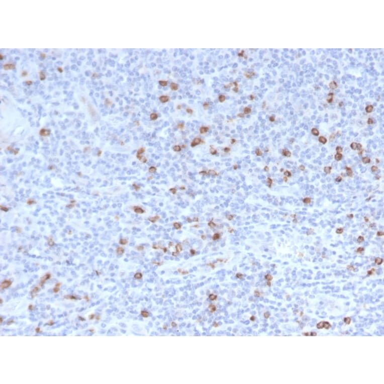 Immunohistochemistry - Anti-Granzyme B Antibody [GZMB/3014] (A248799) - Antibodies.com