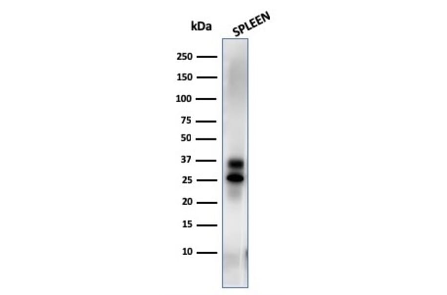 Western Blot - Anti-Granzyme B Antibody [GZMB/3014] (A248799) - Antibodies.com