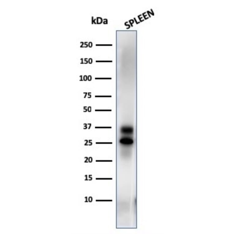 Western Blot - Anti-Granzyme B Antibody [GZMB/3014] (A248799) - Antibodies.com
