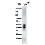 Western Blot - Anti-Granzyme B Antibody [GZMB/3014] (A248799) - Antibodies.com