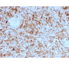 Immunohistochemistry - Anti-Granzyme B Antibody [GZMB/3055] (A248800) - Antibodies.com