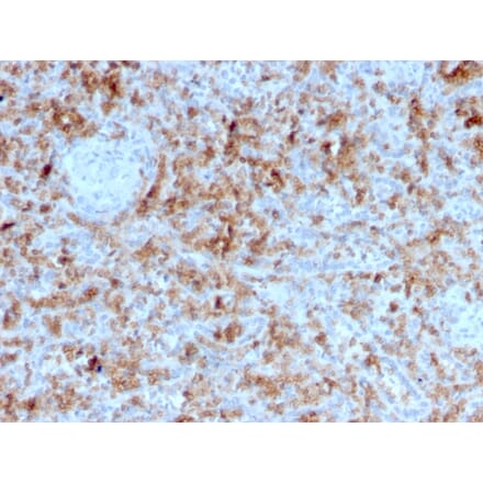Immunohistochemistry - Anti-Granzyme B Antibody [GZMB/3055] (A248800) - Antibodies.com
