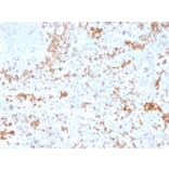 Immunohistochemistry - Anti-Granzyme B Antibody [GZMB/3055] (A248800) - Antibodies.com
