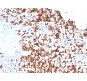 Immunohistochemistry - Anti-Granzyme B Antibody [GZMB/3056] (A248801) - Antibodies.com