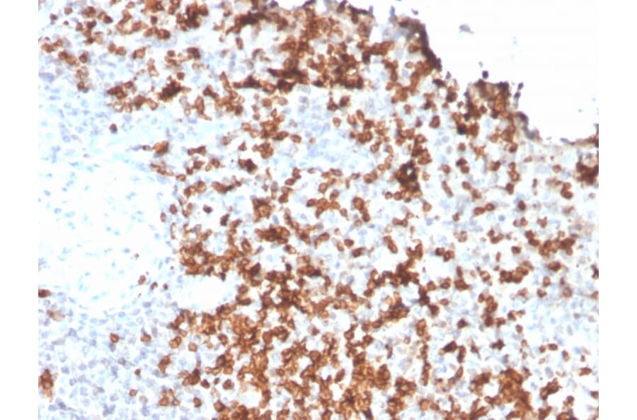 Immunohistochemistry - Anti-Granzyme B Antibody [GZMB/3056] (A248801) - Antibodies.com