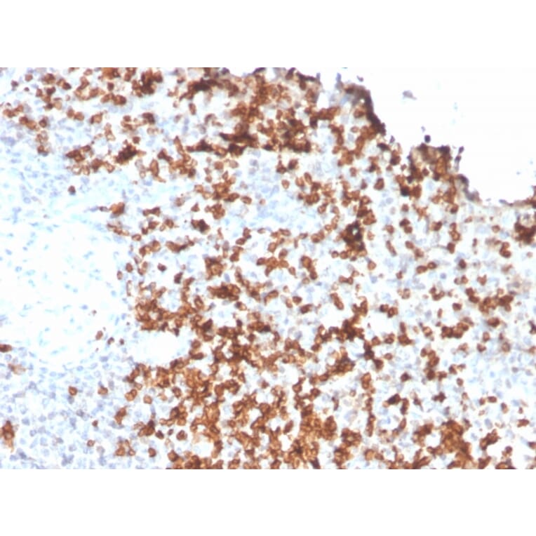 Immunohistochemistry - Anti-Granzyme B Antibody [GZMB/3056] (A248801) - Antibodies.com