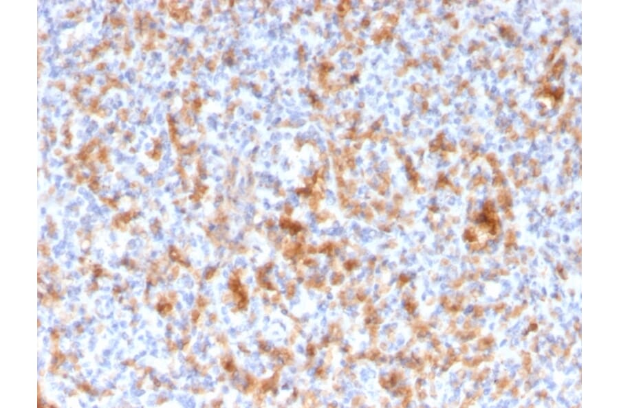 Immunohistochemistry - Anti-Granzyme B Antibody [GZMB/3056] (A248801) - Antibodies.com