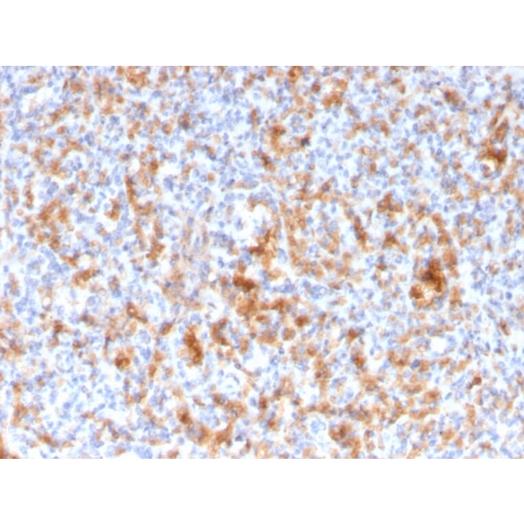Immunohistochemistry - Anti-Granzyme B Antibody [GZMB/3056] (A248801) - Antibodies.com