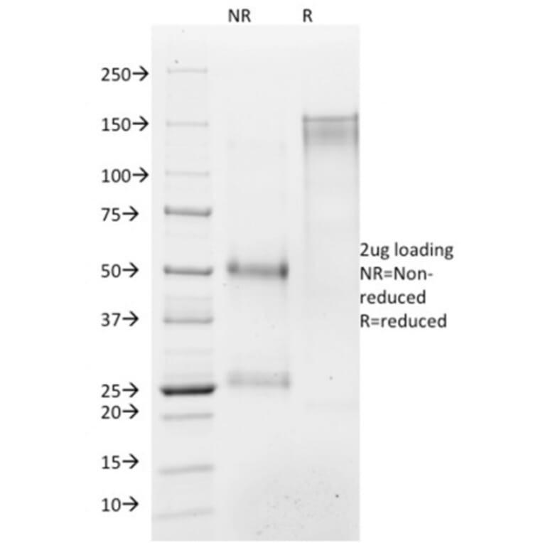 SDS-PAGE - Anti-Histone H1 Antibody [AE-4] (A248802) - Antibodies.com