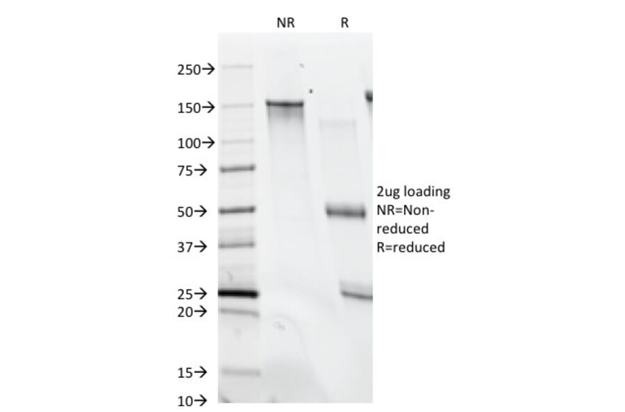 SDS-PAGE - Anti-Histone H1 Antibody [SPM256] (A248803) - Antibodies.com