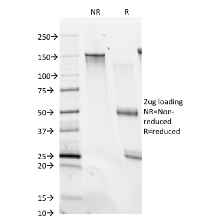 SDS-PAGE - Anti-Histone H1 Antibody [SPM256] (A248803) - Antibodies.com