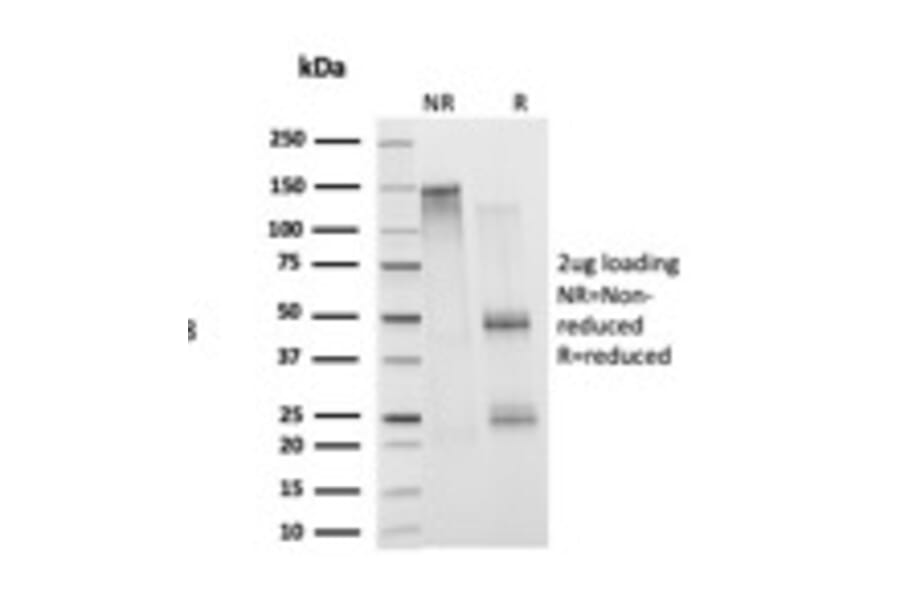 SDS-PAGE - Anti-Histone H1 Antibody [1415-1] (A248804) - Antibodies.com