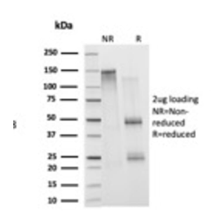 SDS-PAGE - Anti-Histone H1 Antibody [1415-1] (A248804) - Antibodies.com