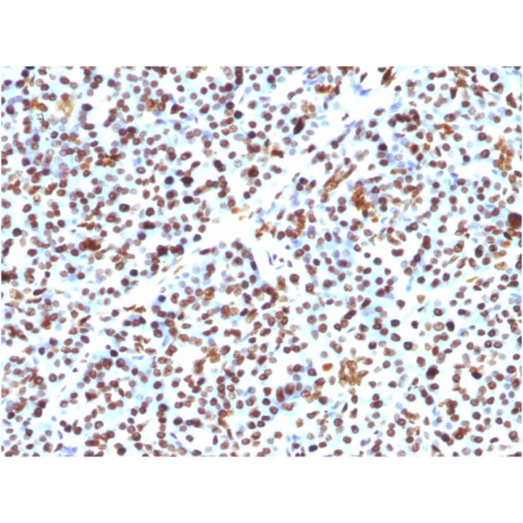 Immunohistochemistry - Anti-Histone H1 Antibody [HH1/957] (A248805) - Antibodies.com