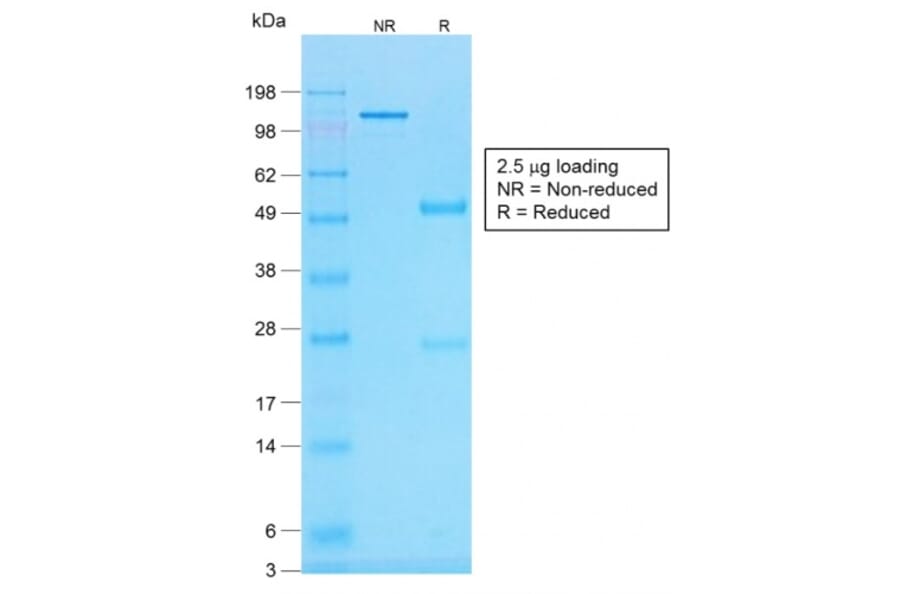 SDS-PAGE - Anti-Histone H1 Antibody [r1415-1] (A248806) - Antibodies.com