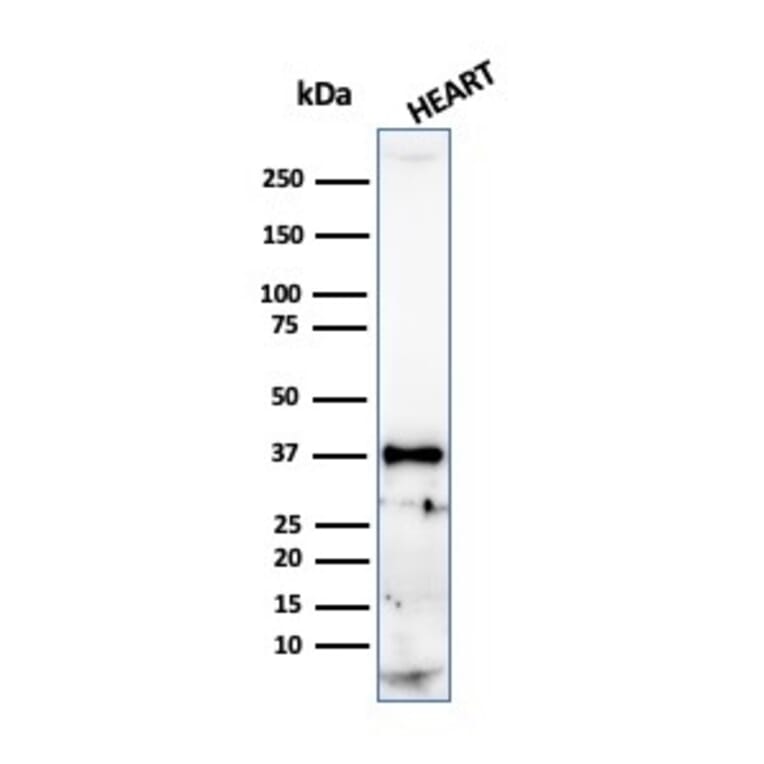 Western Blot - Anti-Histone H1 Antibody [r1415-1] (A248806) - Antibodies.com