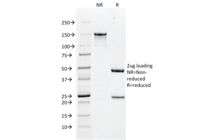 SDS-PAGE - Anti-Histone H1 Antibody [rAE-4] (A248807) - Antibodies.com
