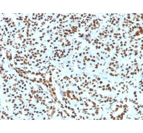 Immunohistochemistry - Anti-Histone H1 Antibody [HH1/1784R] (A248808) - Antibodies.com