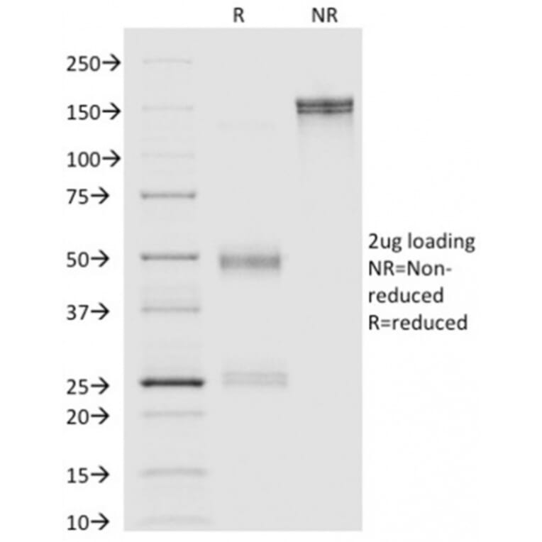 SDS-PAGE - Anti-Annexin A1 Antibody [ANXA1/1671] (A248812) - Antibodies.com