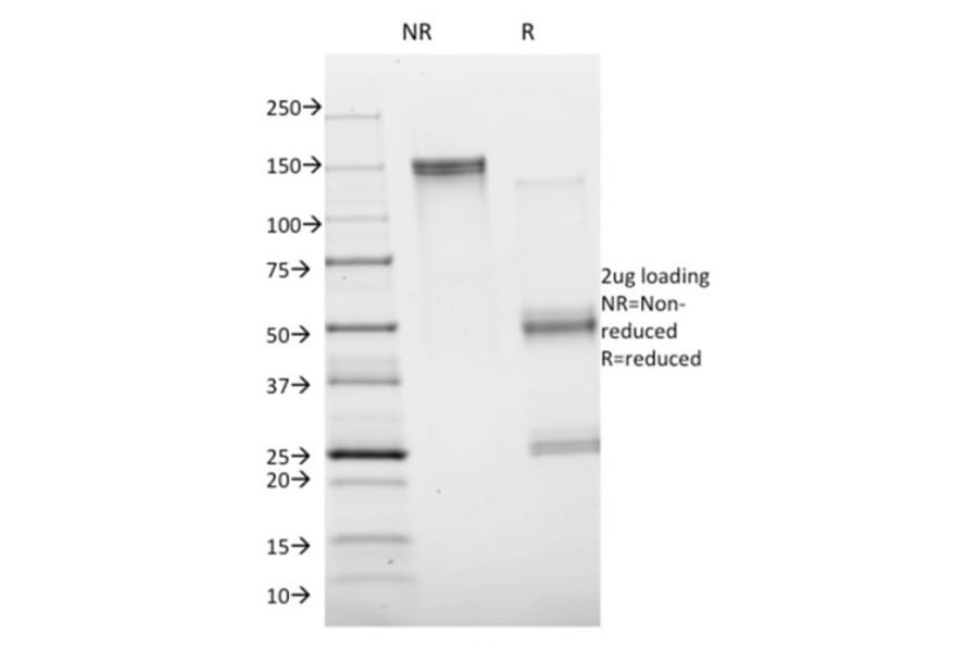 SDS-PAGE - Anti-Annexin A1 Antibody [ANXA1/1672] (A248813) - Antibodies.com