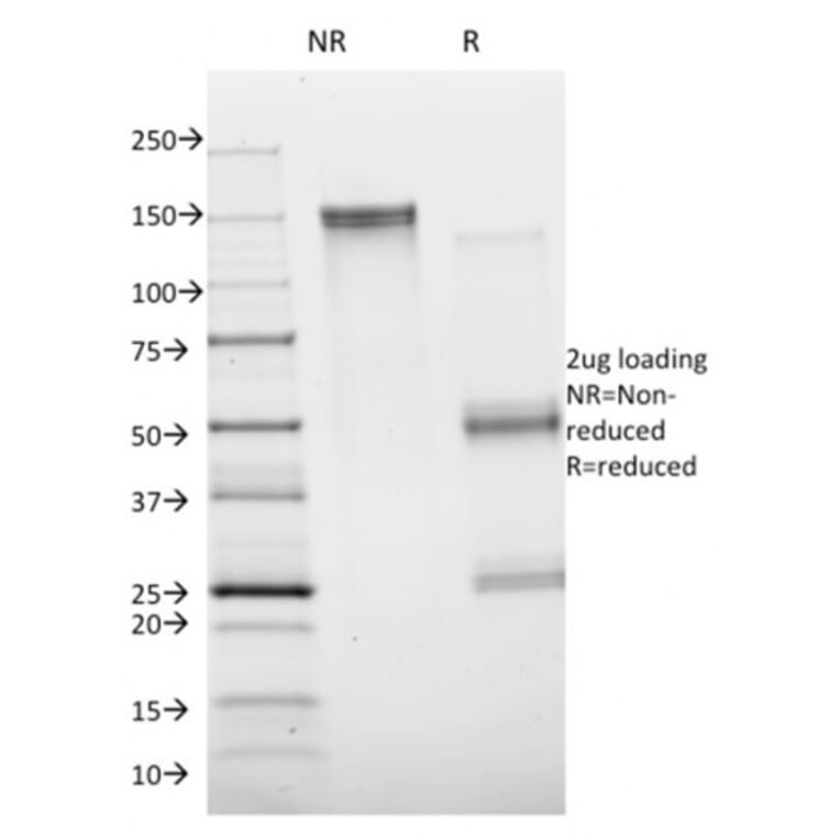 SDS-PAGE - Anti-Annexin A1 Antibody [ANXA1/1672] (A248813) - Antibodies.com