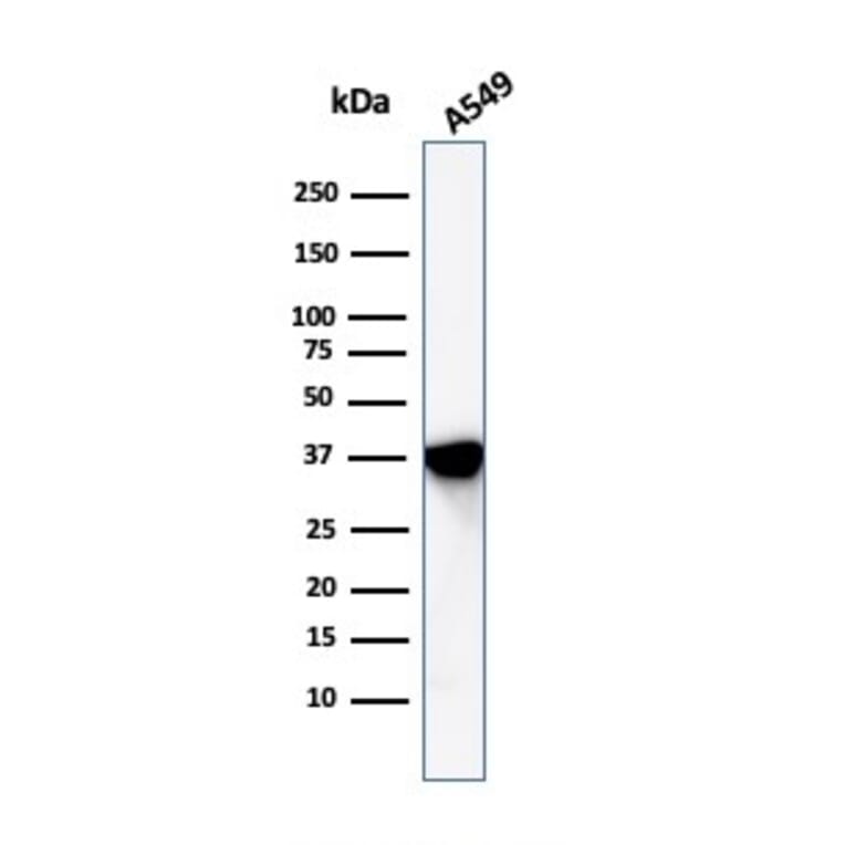 Western Blot - Anti-Annexin A1 Antibody [ANXA1/1672] (A248813) - Antibodies.com