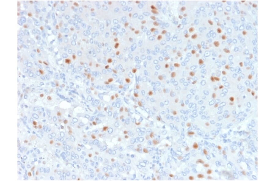 Immunohistochemistry - Anti-Annexin A1 Antibody [6E4/3] (A248815) - Antibodies.com
