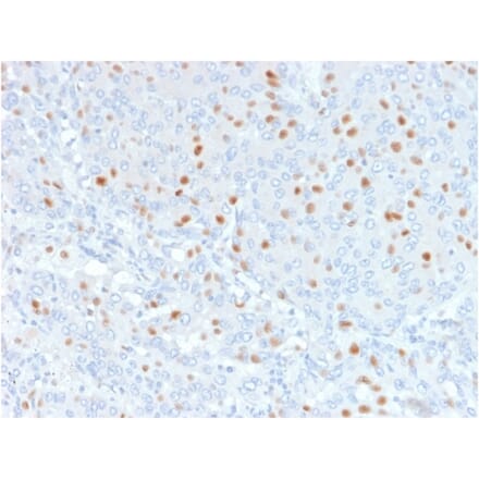 Immunohistochemistry - Anti-Annexin A1 Antibody [6E4/3] (A248815) - Antibodies.com