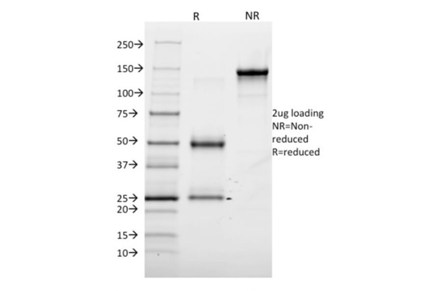 SDS-PAGE - Anti-Annexin A1 Antibody [6E4/3] (A248815) - Antibodies.com