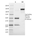 SDS-PAGE - Anti-Annexin A1 Antibody [6E4/3] (A248815) - Antibodies.com