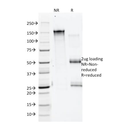 SDS-PAGE - Anti-Annexin A1 Antibody [5E4/1] (A248816) - Antibodies.com