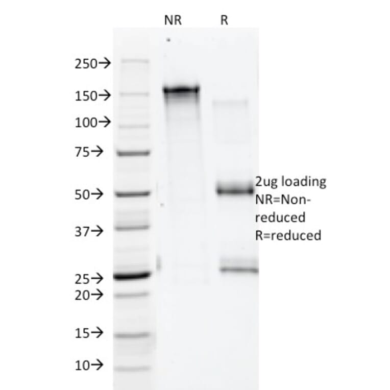 SDS-PAGE - Anti-Annexin A1 Antibody [5E4/1] (A248816) - Antibodies.com