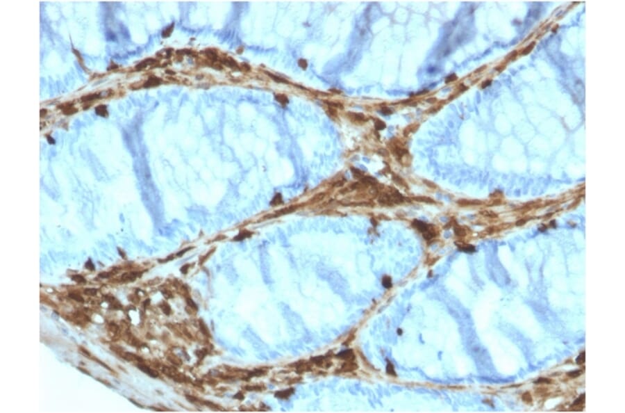 Immunohistochemistry - Anti-Annexin A1 Antibody [ANXA1/3566] (A248817) - Antibodies.com
