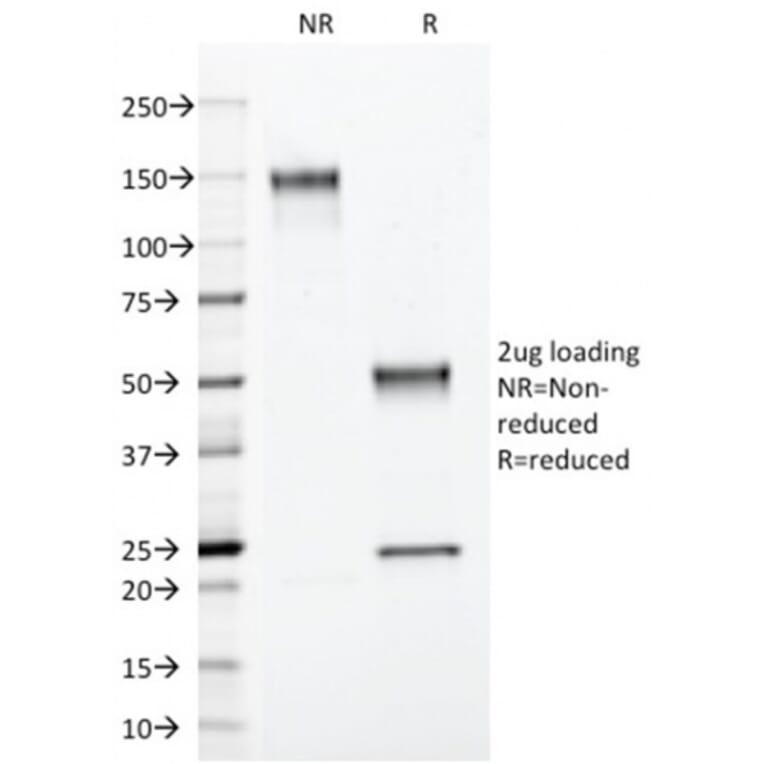 SDS-PAGE - Anti-Annexin A1 Antibody [ANXA1/3566] (A248817) - Antibodies.com