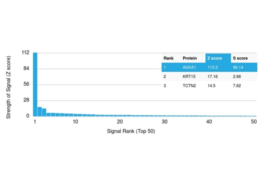 Protein Array - Anti-Annexin A1 Antibody [ANXA1/3566] (A248816) - Antibodies.com