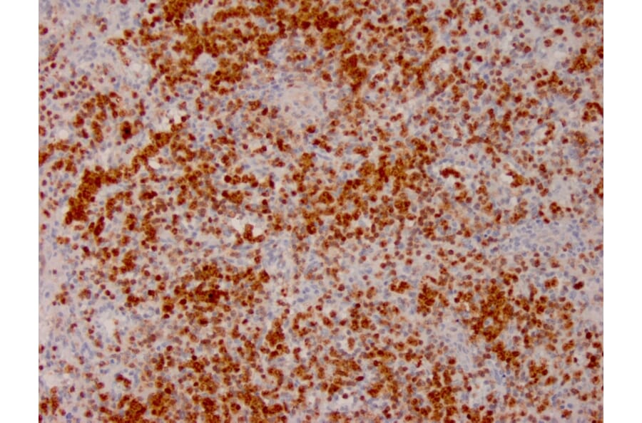 Immunohistochemistry - Anti-Annexin A1 Antibody [ANXA1/3566] (A248817) - Antibodies.com