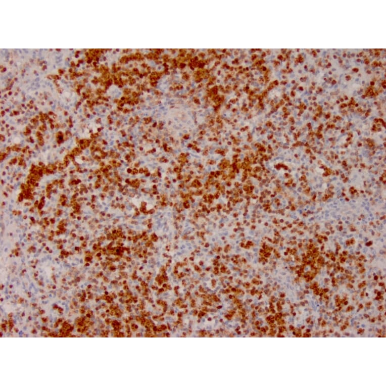 Immunohistochemistry - Anti-Annexin A1 Antibody [ANXA1/3566] (A248817) - Antibodies.com