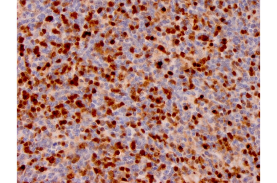 Immunohistochemistry - Anti-Annexin A1 Antibody [ANXA1/3566] (A248817) - Antibodies.com