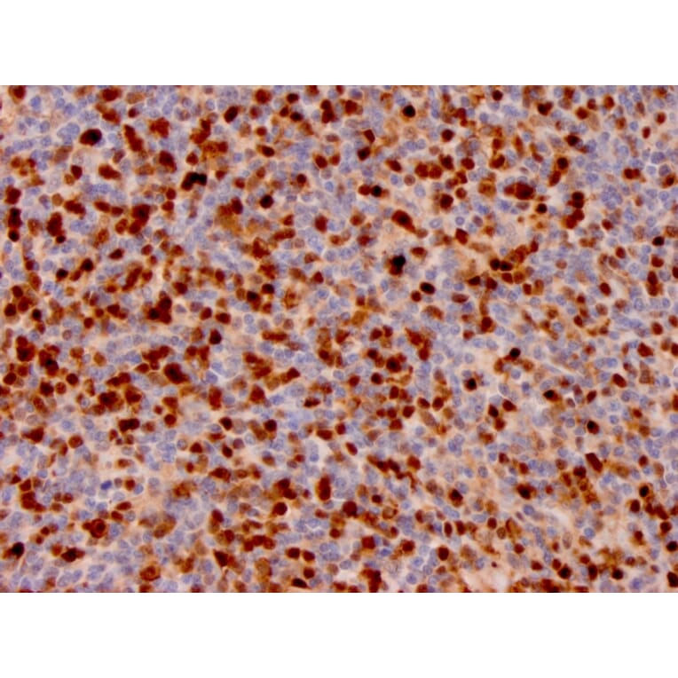 Immunohistochemistry - Anti-Annexin A1 Antibody [ANXA1/3566] (A248817) - Antibodies.com