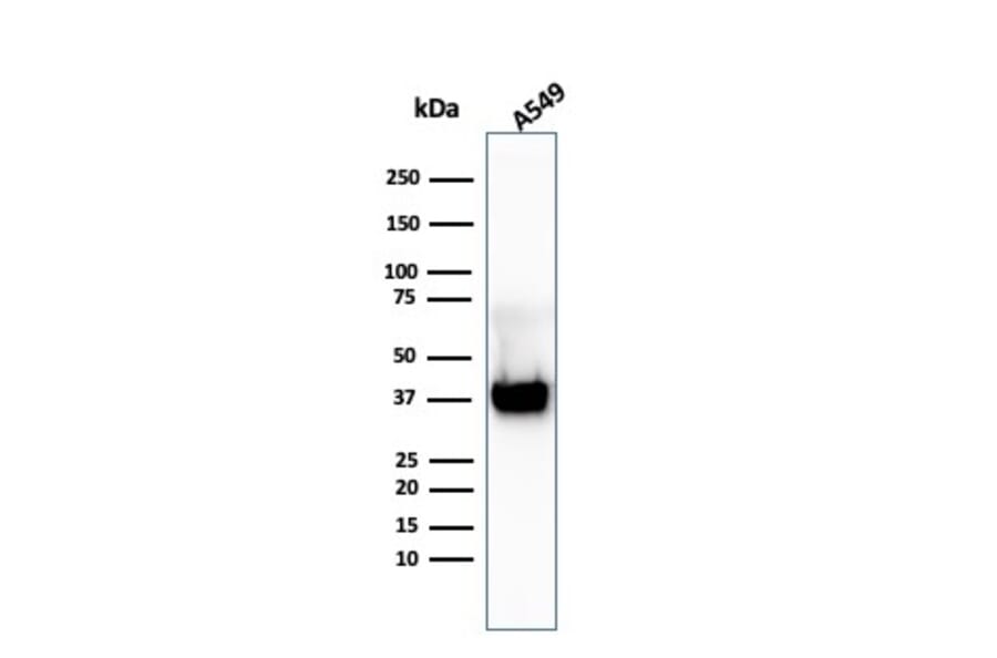 Western Blot - Anti-Annexin A1 Antibody [ANXA1/3869R] (A248820) - Antibodies.com