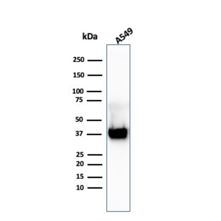 Western Blot - Anti-Annexin A1 Antibody [ANXA1/3869R] (A248820) - Antibodies.com