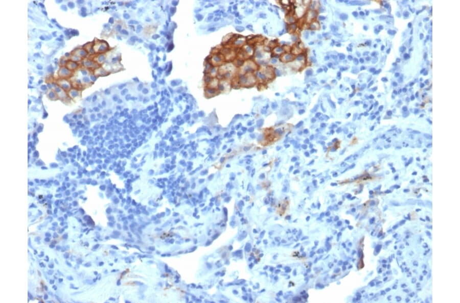 Immunohistochemistry - Anti-DC-SIGN Antibody [C209/1781] (A248822) - Antibodies.com