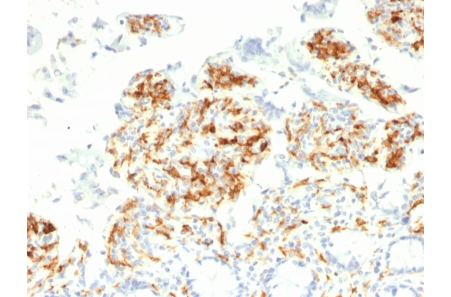 Immunohistochemistry - Anti-DC-SIGN Antibody [C209/1781] (A248822) - Antibodies.com