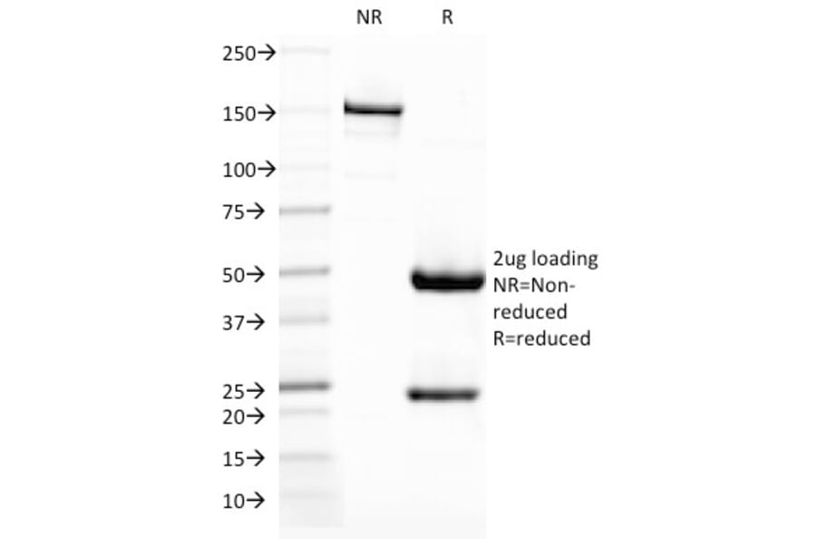 SDS-PAGE - Anti-DC-SIGN Antibody [C209/1781] (A248822) - Antibodies.com